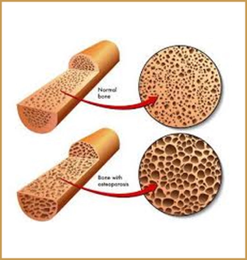 Rebuilds Bone Density