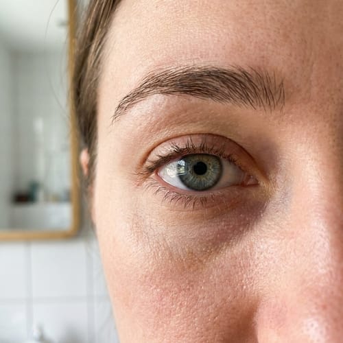Clear, healthy eye close-up