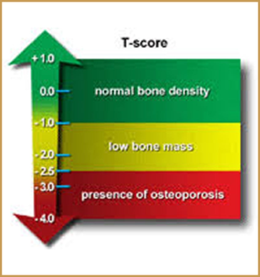 Improve T Score
